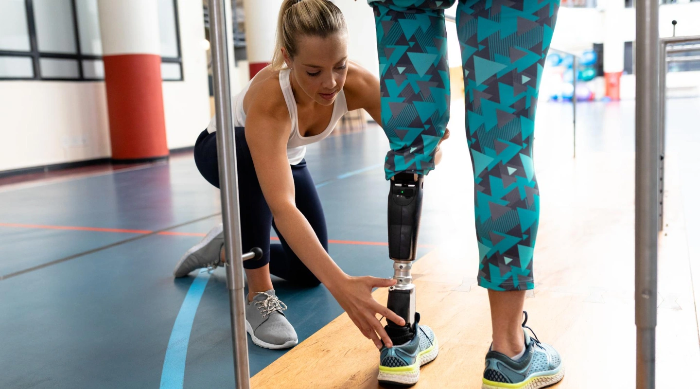 Life After Amputation: Prosthetics, Rehab, and Home Access Providers