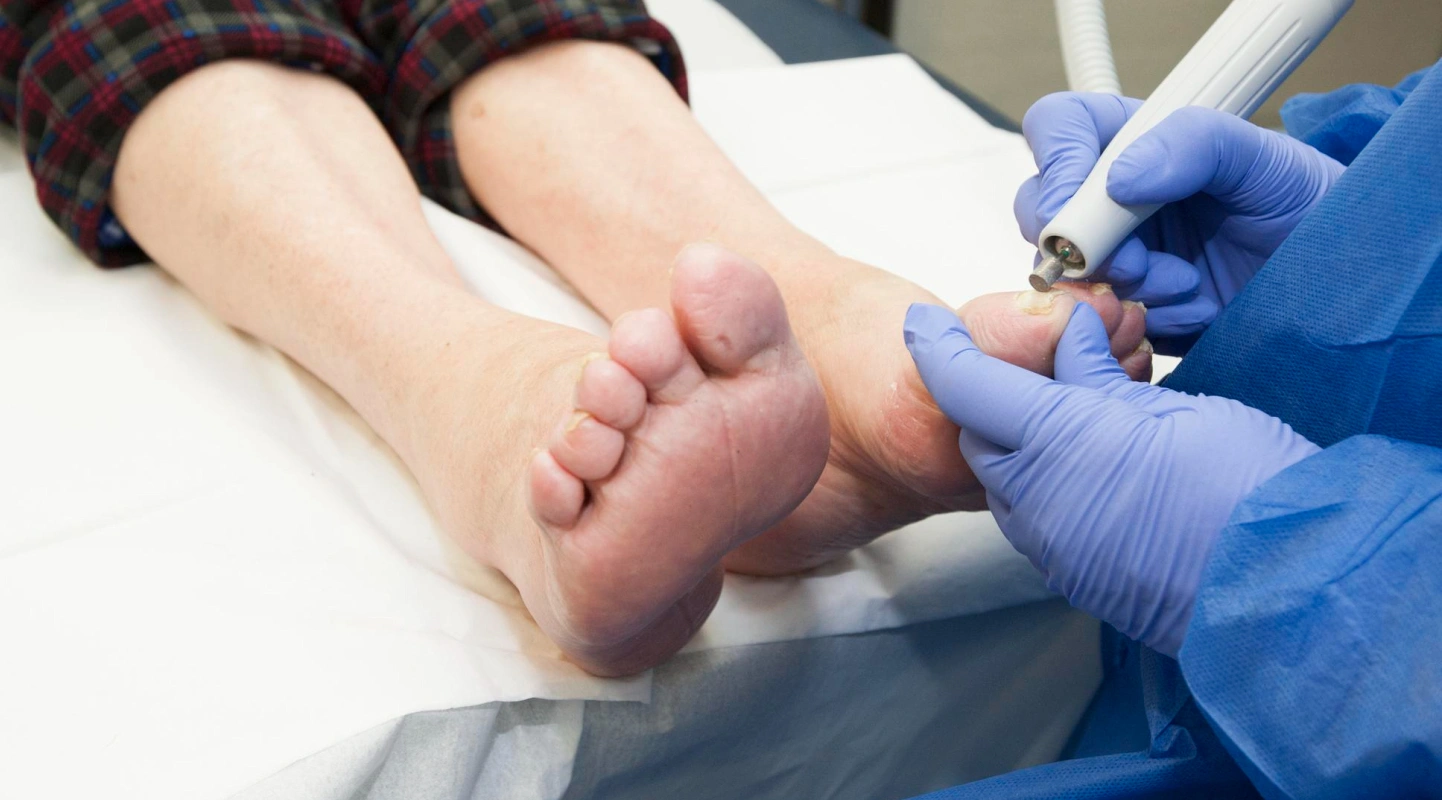 NDIS Podiatry Client Acquisition: 2026 Guide