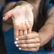 Ehlers-Danlos Syndrome